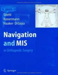 Navigation and MIS in Orthopedic Surgery