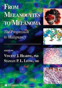 From Melanocytes to Melanoma: The Progression to Malignancy