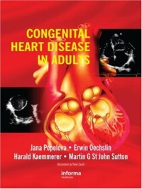 Congenital Heart Disease in Adults