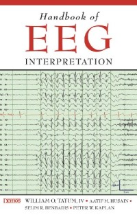 Handbook of Eeg Interpretation